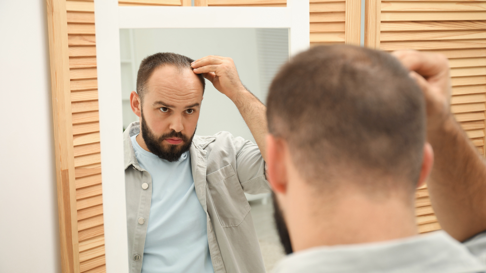 טיפול בהתקרחות